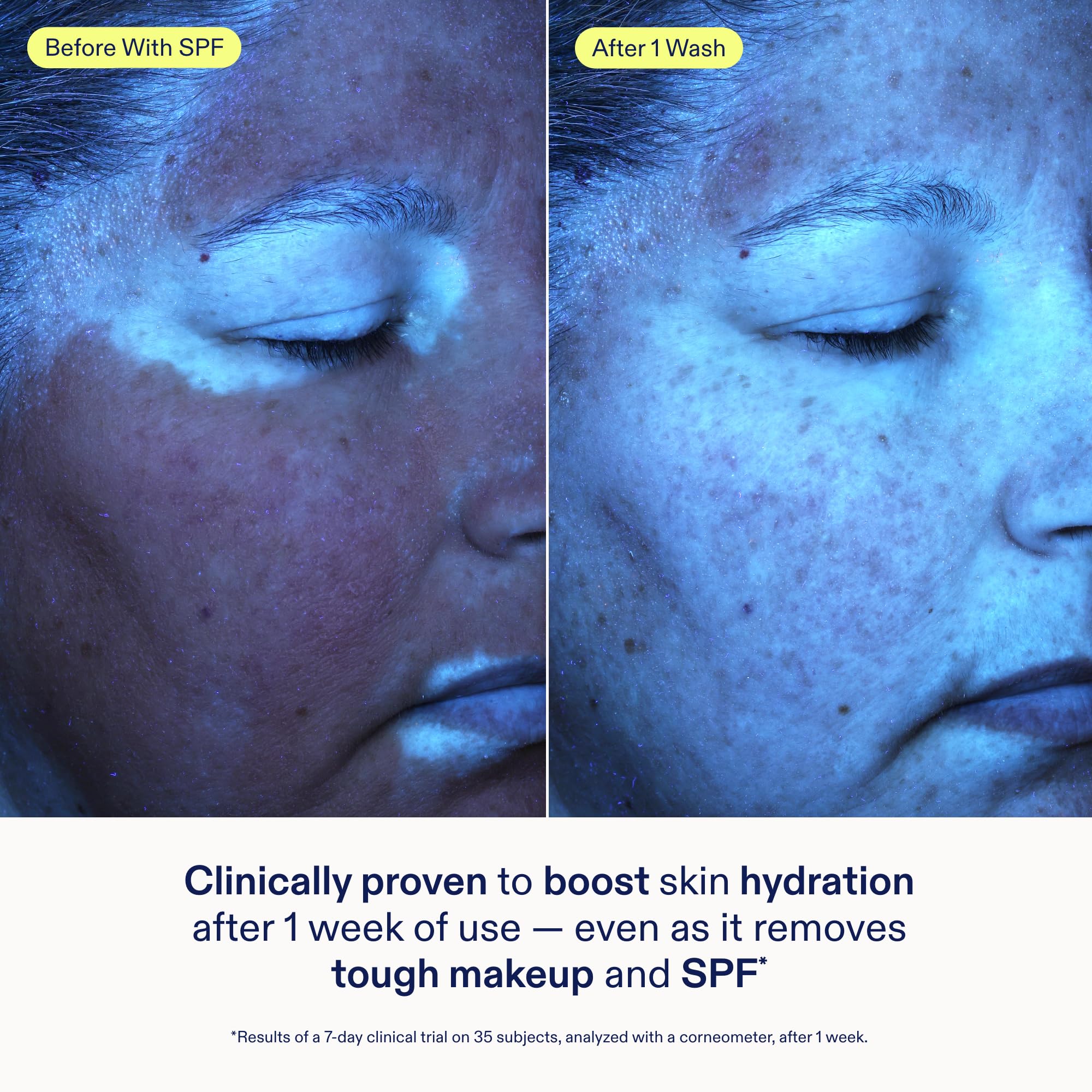 Skinfix Ceramide + Ectoin Gentle Gel Cleanser Mini – Removes Makeup & SPF, Hydrates Skin | Vegan & Cruelty-Free