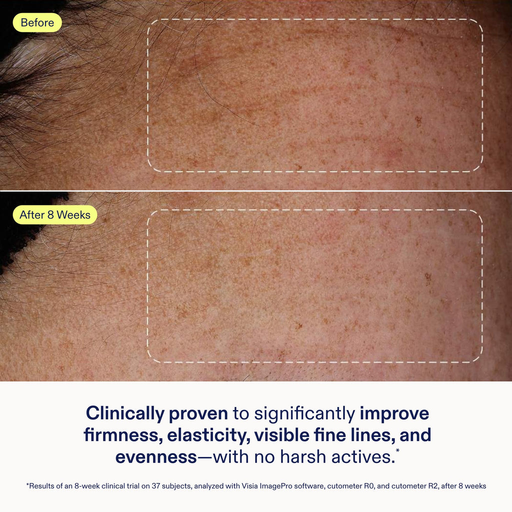 Skinfix Exo + Ectoin Intensive Repair Baume – Retinol-Free Serum with Hyaluronic Acid & Peptides