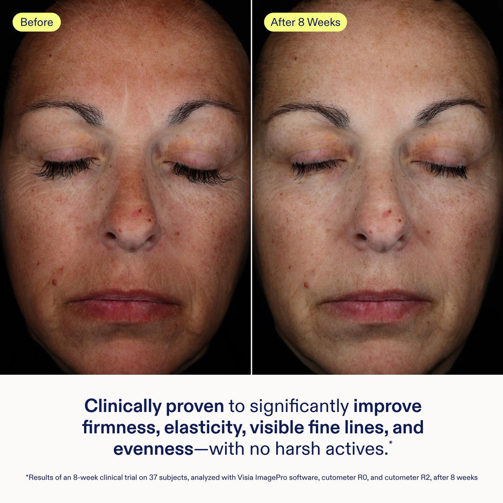 Skinfix Exo + Ectoin Intensive Repair Baume – Retinol-Free Serum with Hyaluronic Acid & Peptides