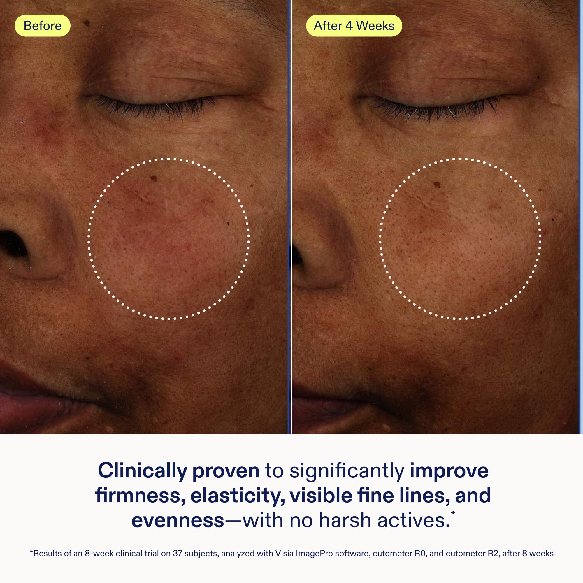 Skinfix Exo + Ectoin Intensive Repair Baume – Retinol-Free Serum with Hyaluronic Acid & Peptides