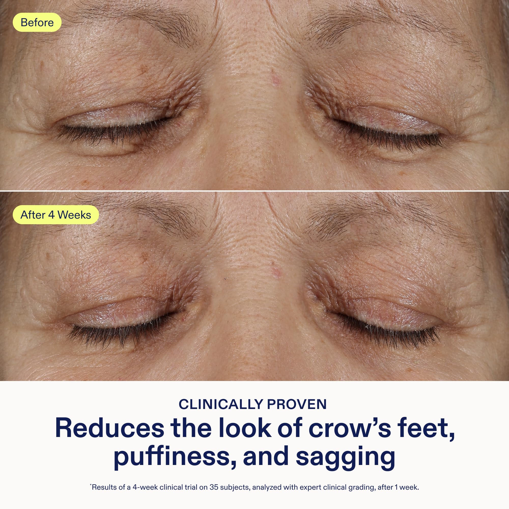 Skinfix Triple Lipid Eye Treatment - 0.5 oz, Fragrance-Free, Vegan Eye Cream