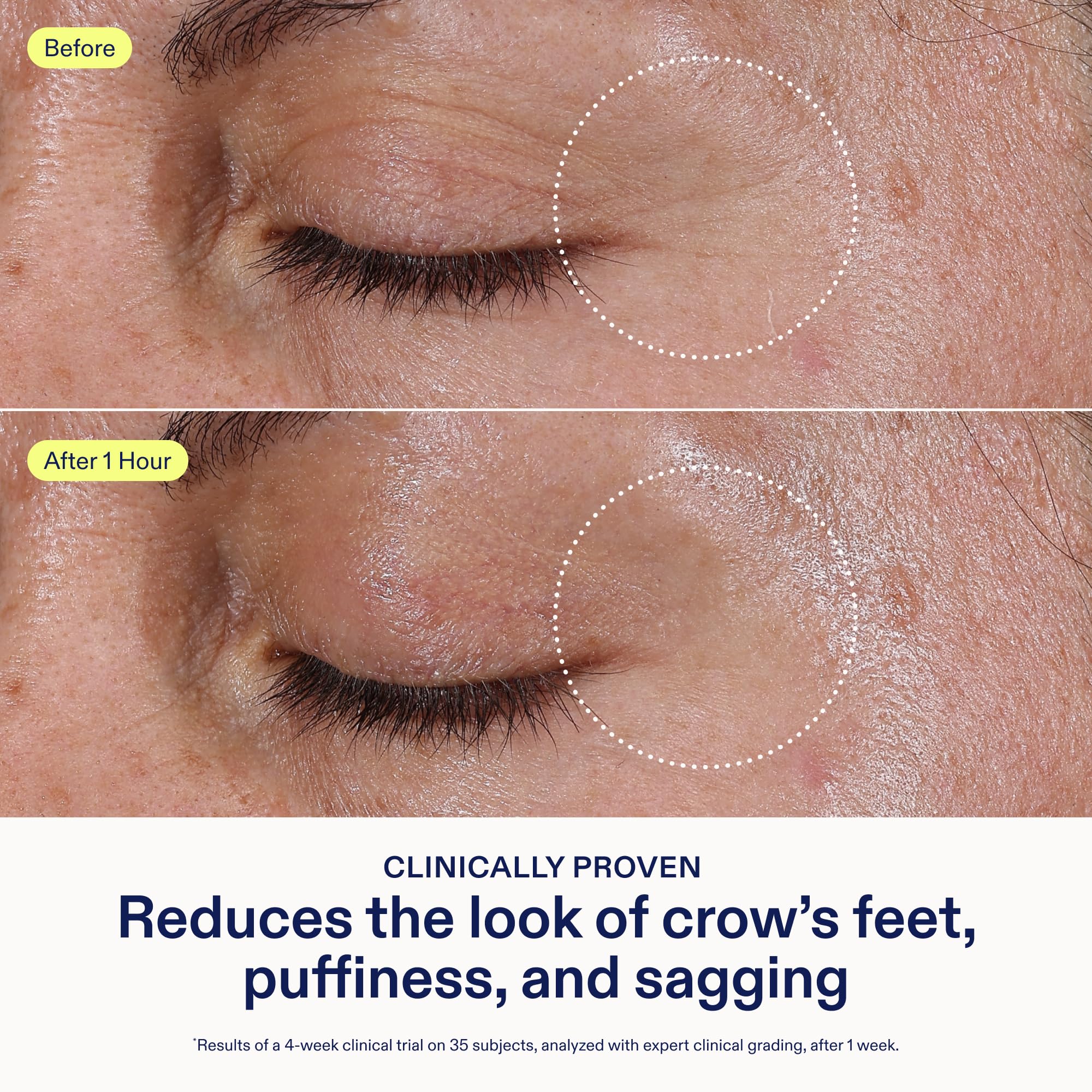 Skinfix Triple Lipid Eye Treatment - 0.5 oz, Fragrance-Free, Vegan Eye Cream