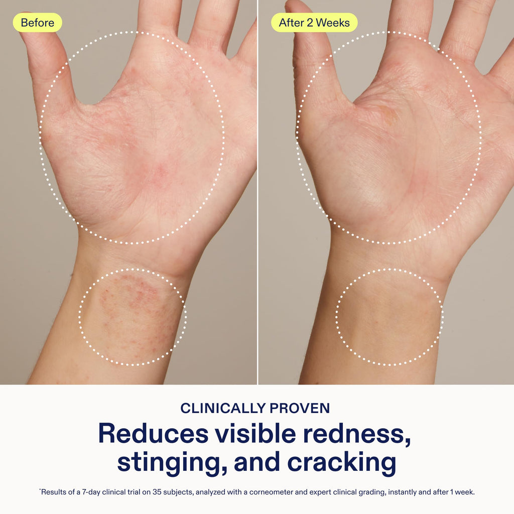 Skinfix Hand Relief Cream – Fragrance Free, 3 oz | Eczema and Dry Hands Care