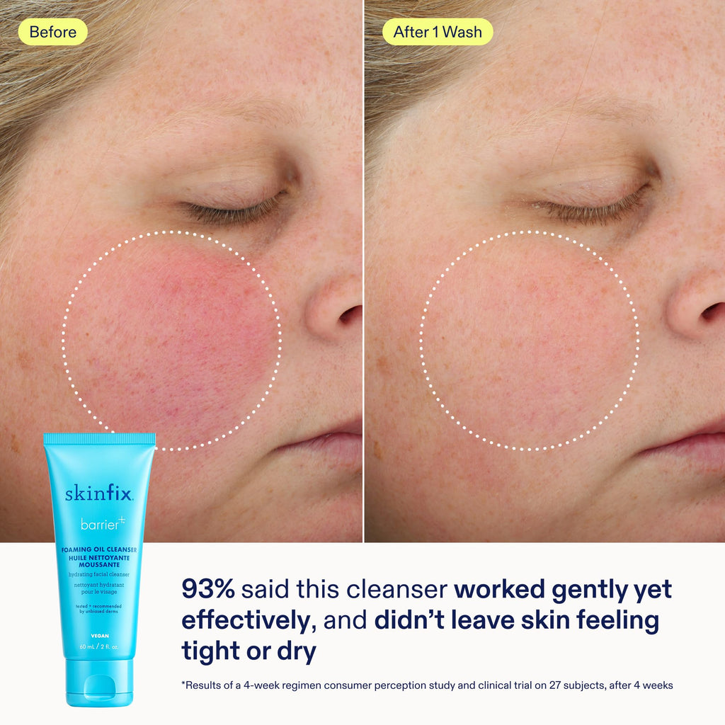 Skinfix Nourishing Cleanse + Moisturize Set with Hyaluronic Acid — Mini Foaming Oil Cleanser + Cream | Vegan & Cruelty-Free