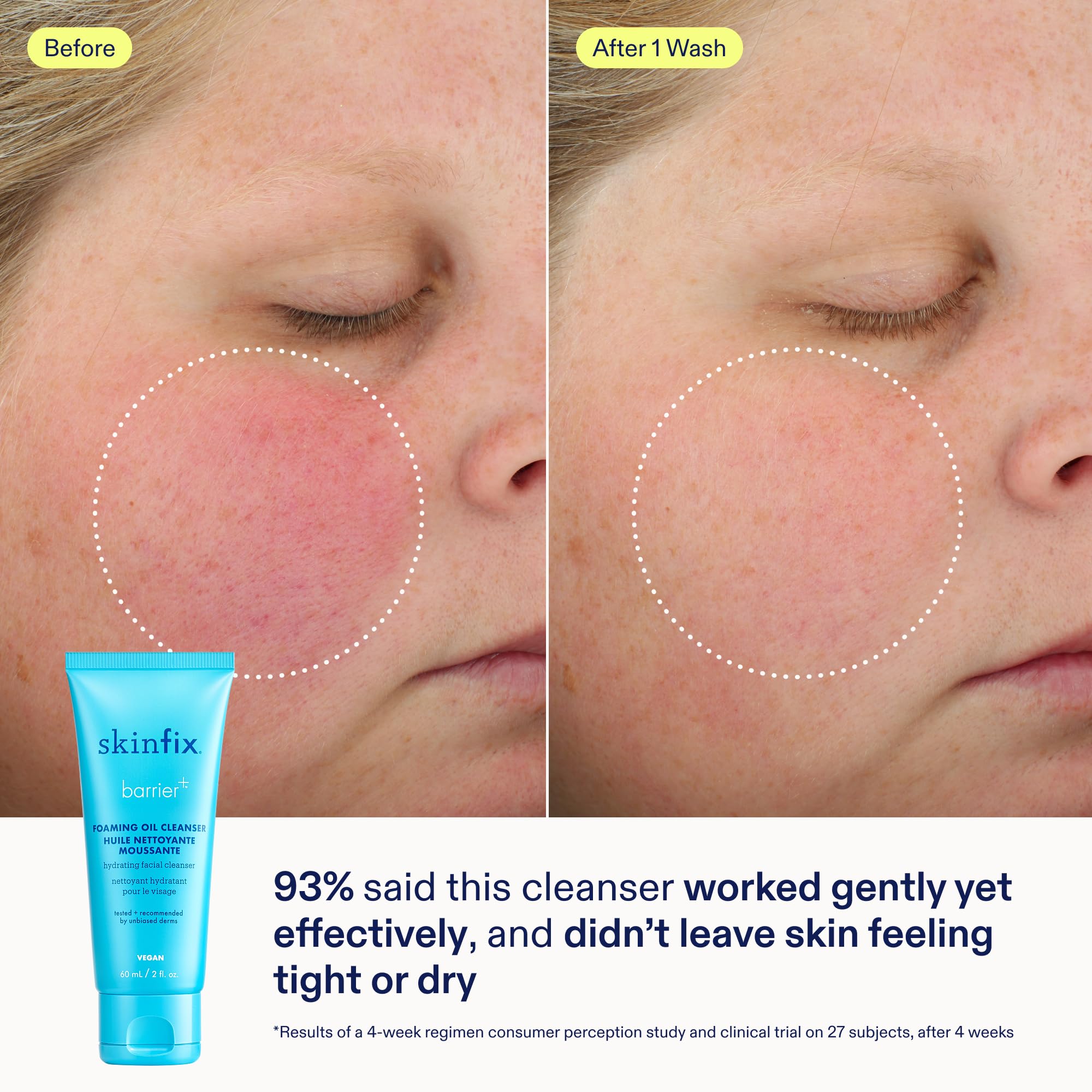 Skinfix Nourishing Cleanse + Moisturize Set with Hyaluronic Acid — Mini Foaming Oil Cleanser + Cream | Vegan & Cruelty-Free