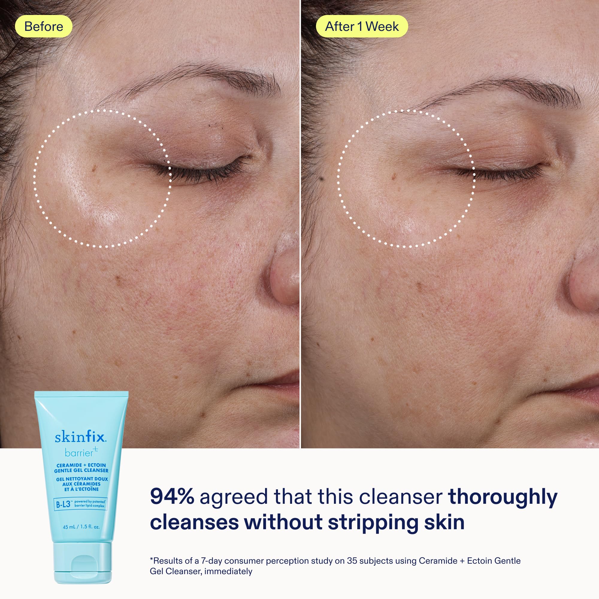 Skinfix Balancing Cleanse + Moisturize Set – Hyaluronic Acid, Mini Ceramide + Ectoin Gentle Gel Cleanser & Barrier Balancing Water Cream – Vegan