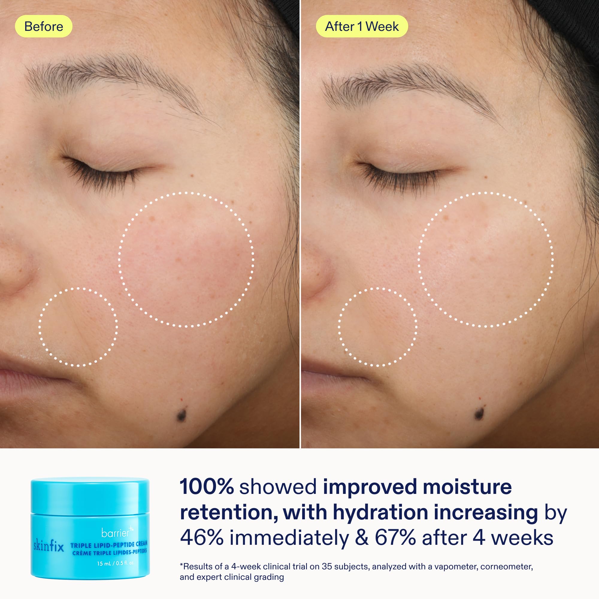 Skinfix Nourishing Cleanse + Moisturize Set with Hyaluronic Acid — Mini Foaming Oil Cleanser + Cream | Vegan & Cruelty-Free