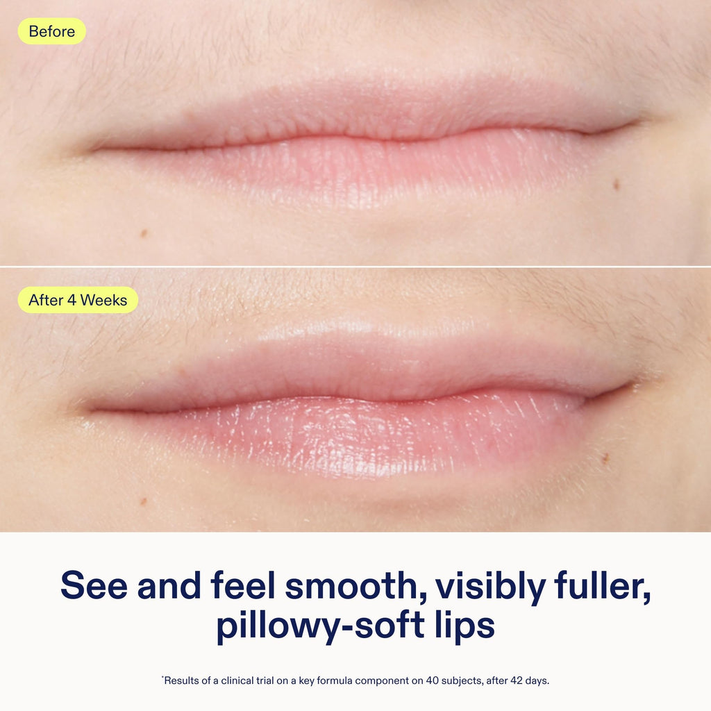 Skinfix Triple Lipid Lip Treatment – Hydrating, Fragrance-Free Lip Balm (0.27 oz) | Vegan & Cruelty-Free