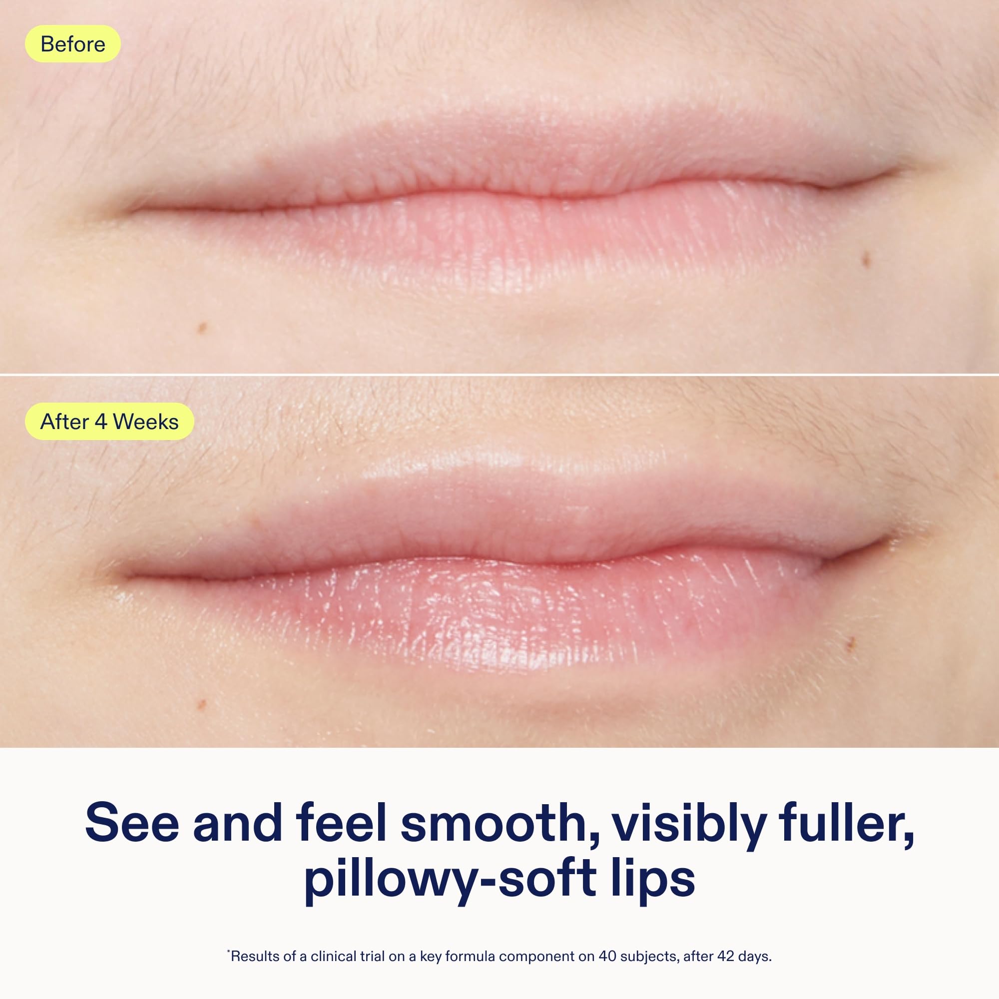 Skinfix Triple Lipid Lip Treatment – Hydrating, Fragrance-Free Lip Balm (0.27 oz) | Vegan & Cruelty-Free