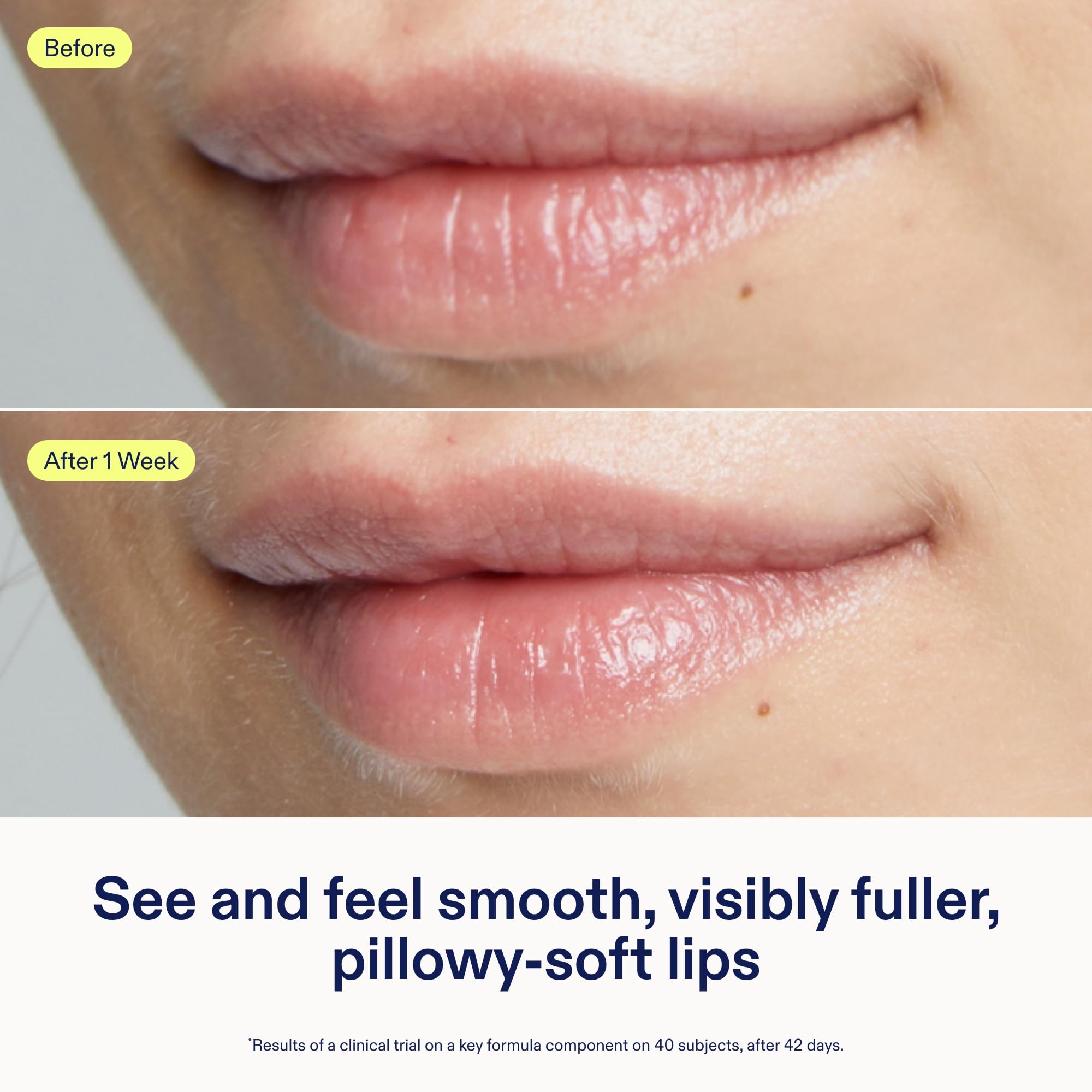 Skinfix Triple Lipid Lip Treatment – Hydrating, Fragrance-Free Lip Balm (0.27 oz) | Vegan & Cruelty-Free