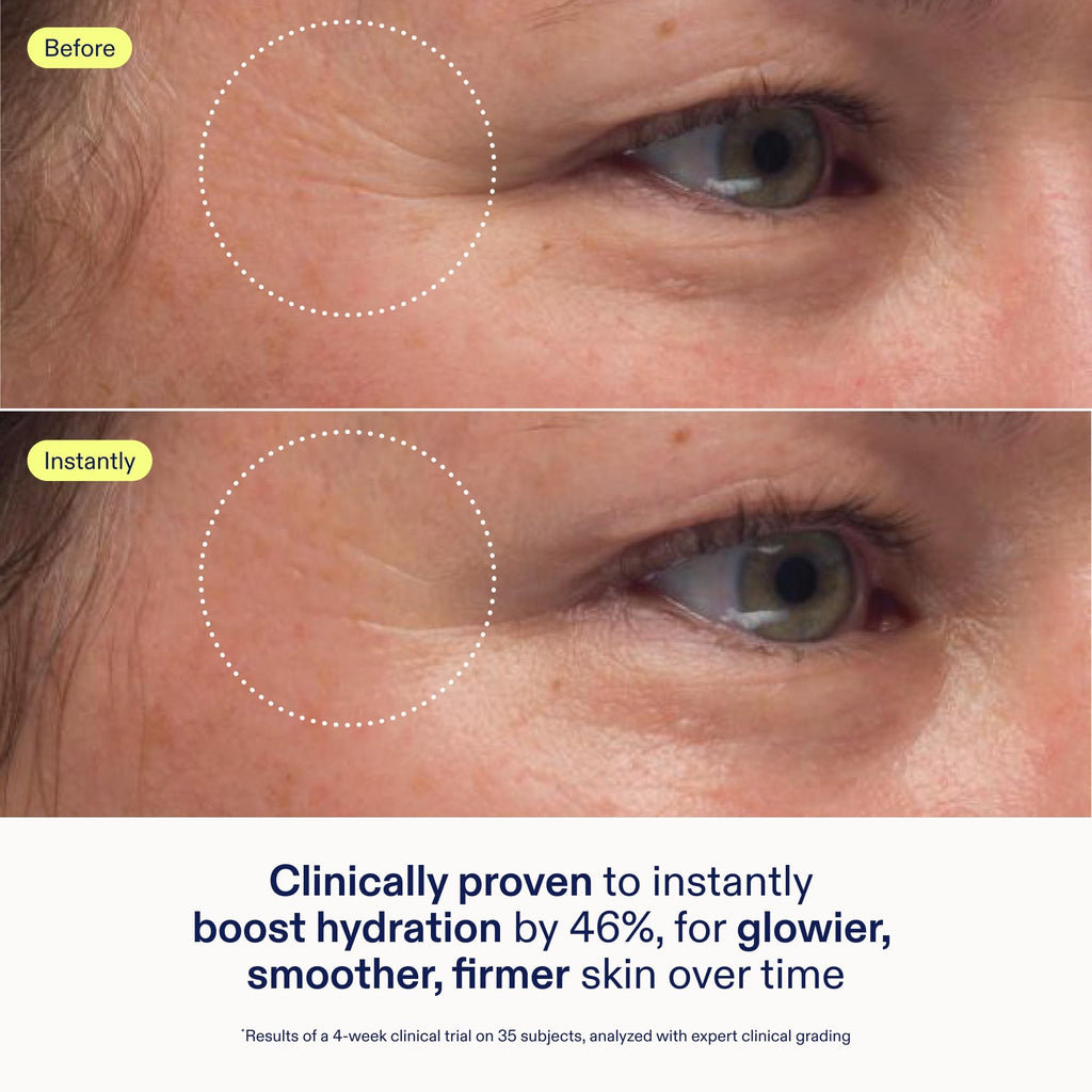 Skinfix Triple Lipid-Peptide Cream | Rich Hydration for Dry & Sensitive Skin
