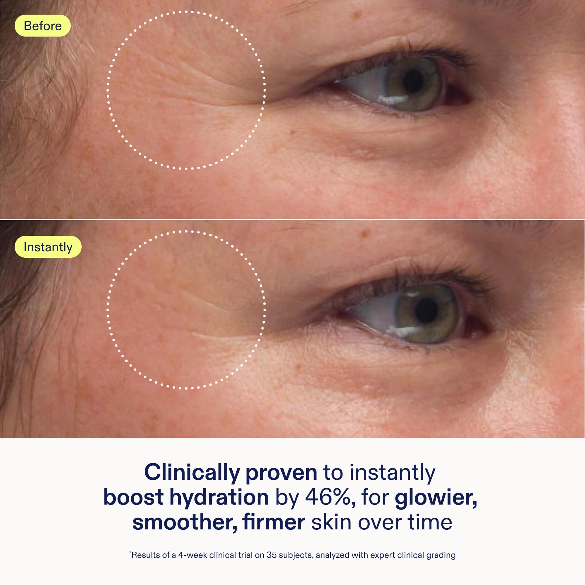 Skinfix Triple Lipid-Peptide Cream | Rich Hydration for Dry & Sensitive Skin