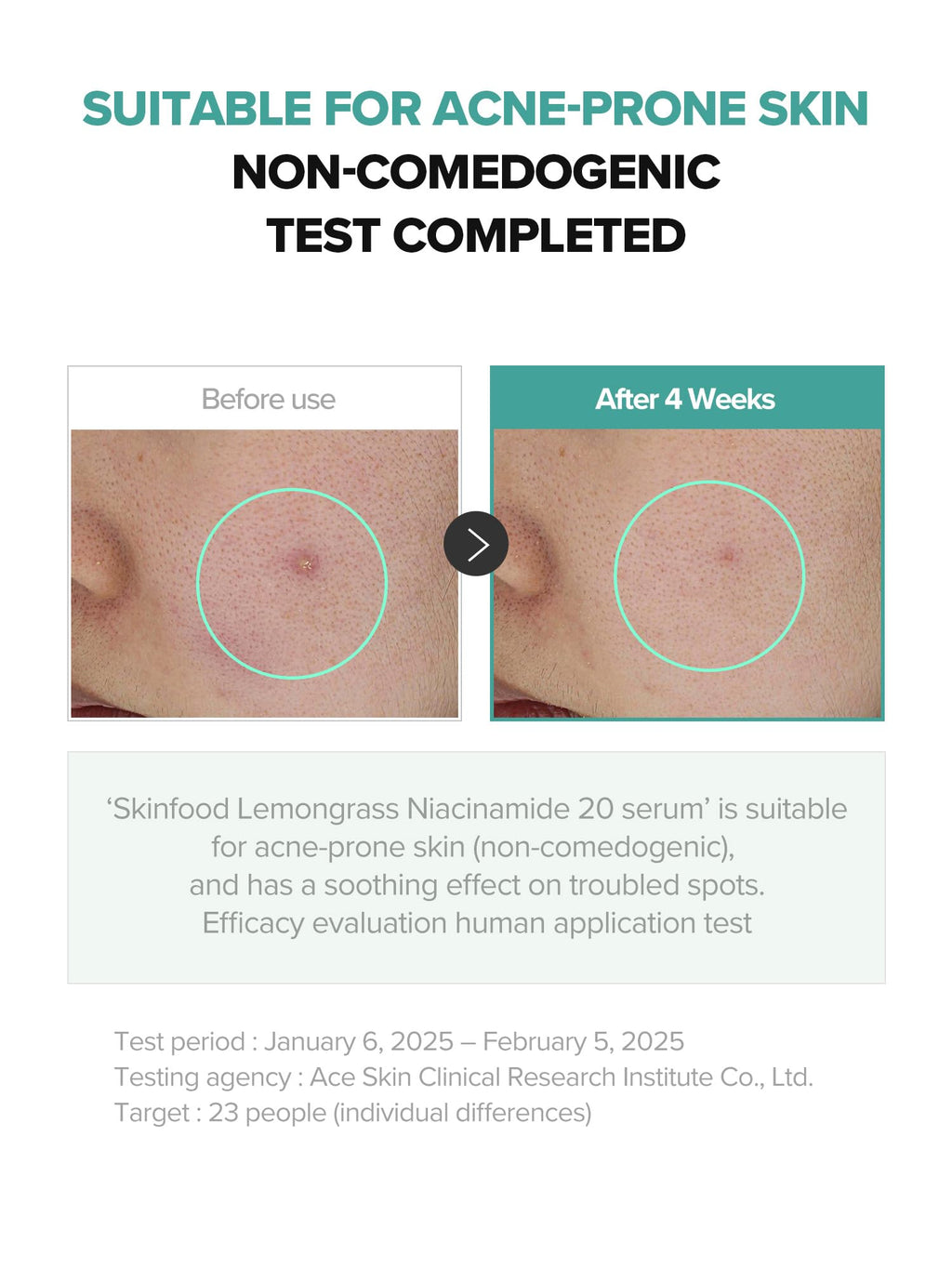 SKINFOOD 1957 Lemongrass Niacinamide 20% Serum — Oily & Sensitive Skin, 50 ml