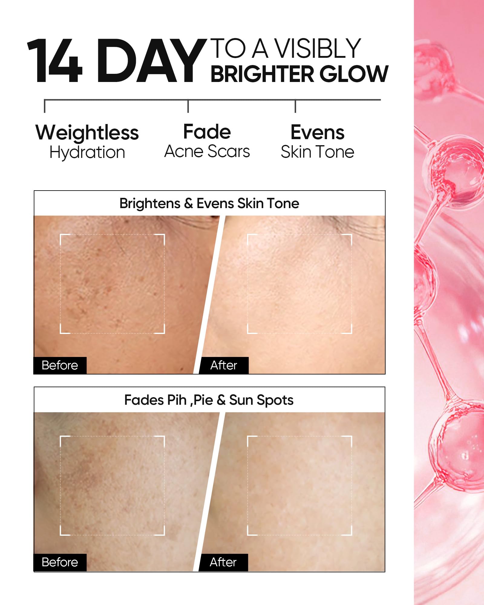 SKINTIFIC MSH Niacinamide Brightening Cream – Fades Dark Spots & Evens Skin Tone