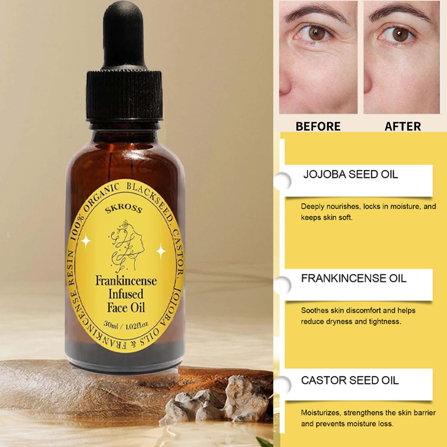 SKROSS Frankincense Resin Oil – Infused Face Oil with Black Seed, Castor & Jojoba (2-Pack)
