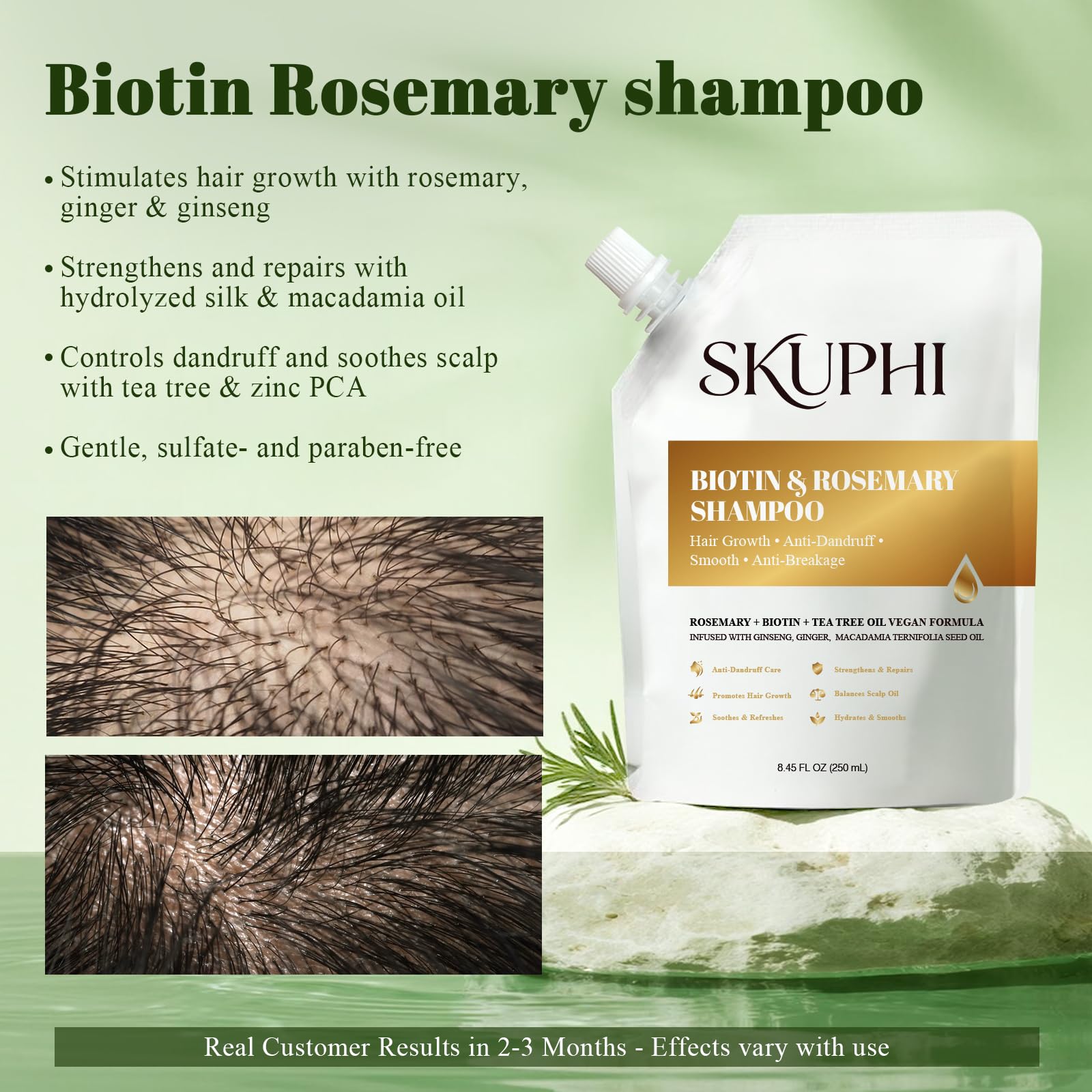 SKUPHI Rosemary Amino Acid Shampoo – Biotin Hair Growth for Thinning Hair, Zinc PCA + Hydrolyzed Silk, 2-Pack (8.45 fl oz)