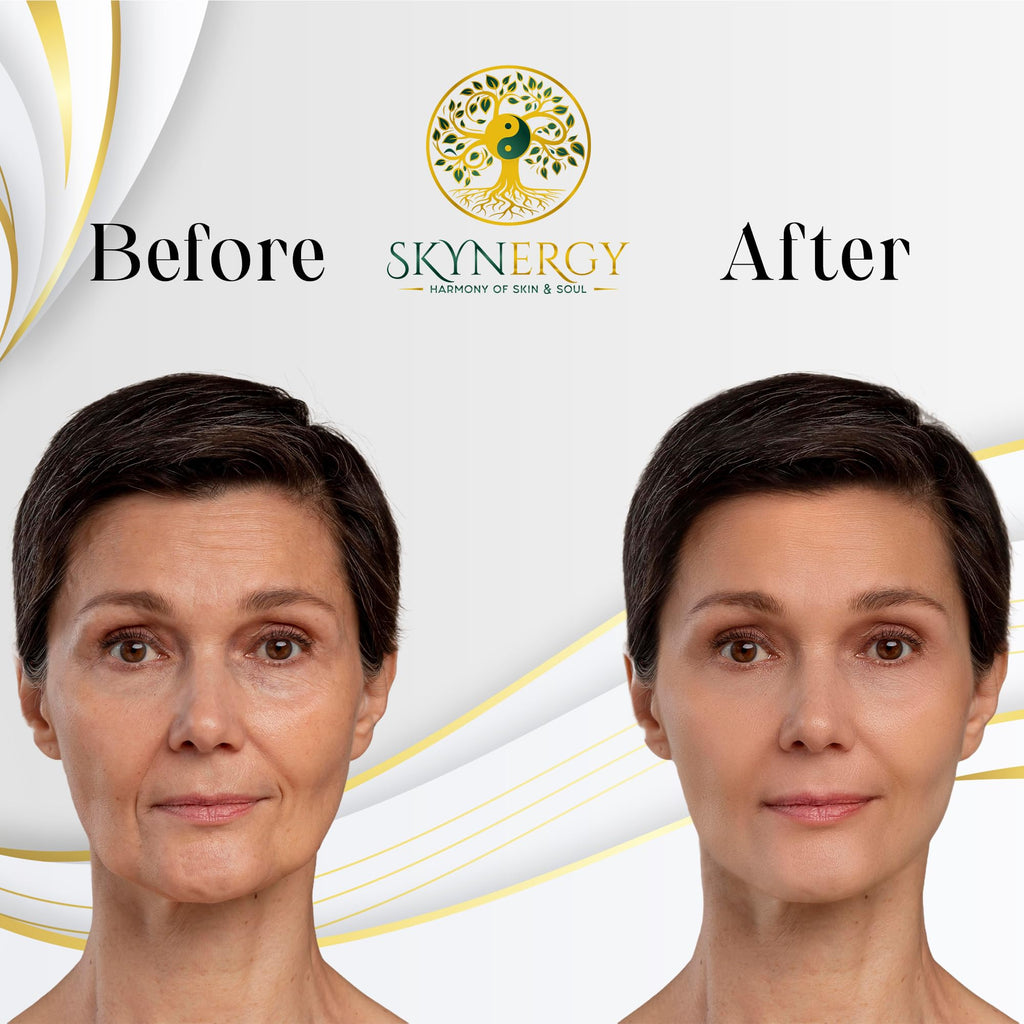 SKYNERGY Australian Sheep Placenta Jelly Mask – Hydration & Glow, All Skin Types (12 Applications)