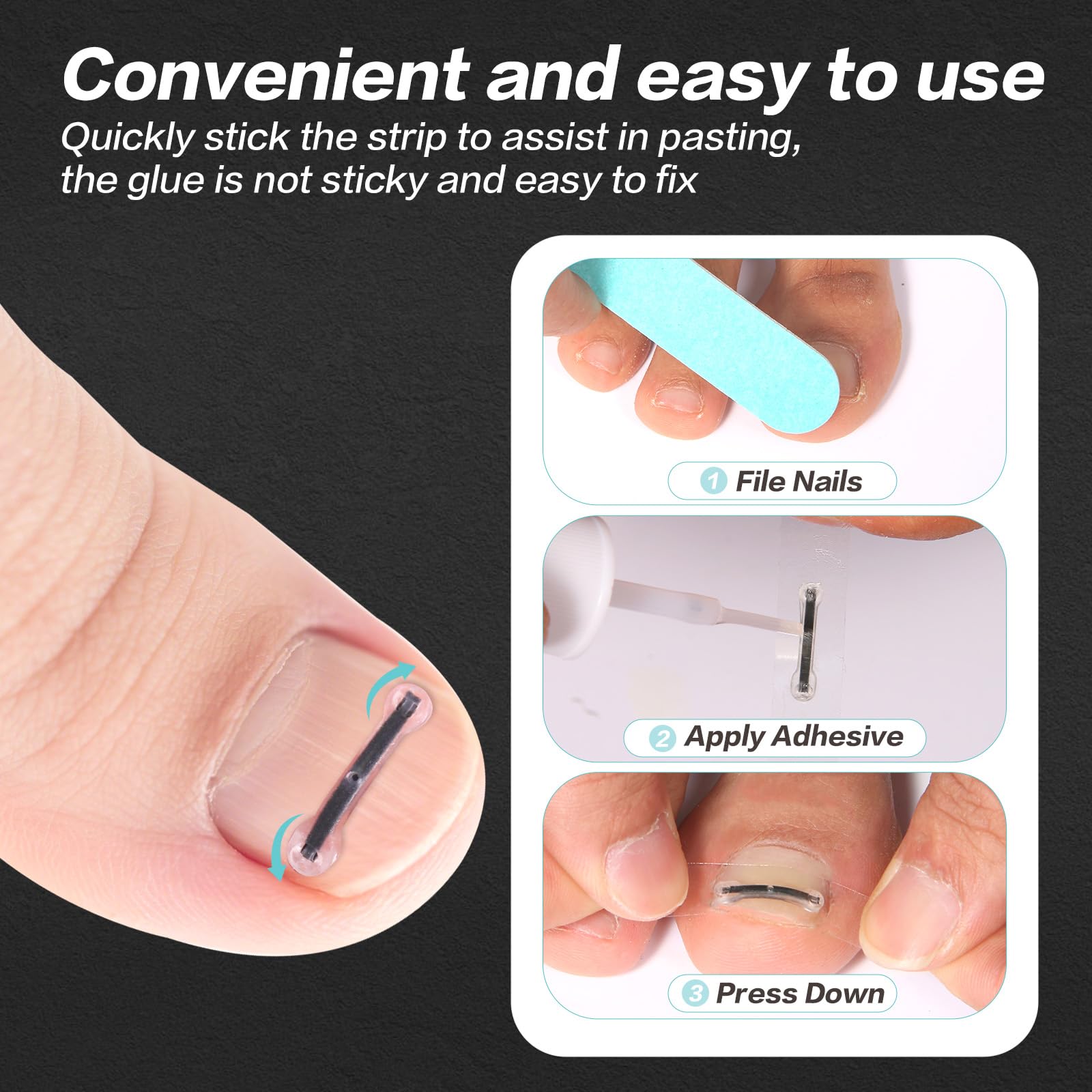 SOAOP Titanium Ingrown Toenail Tool Kit – 10-Piece Curved Nail Corrector (0.59–0.79 in)