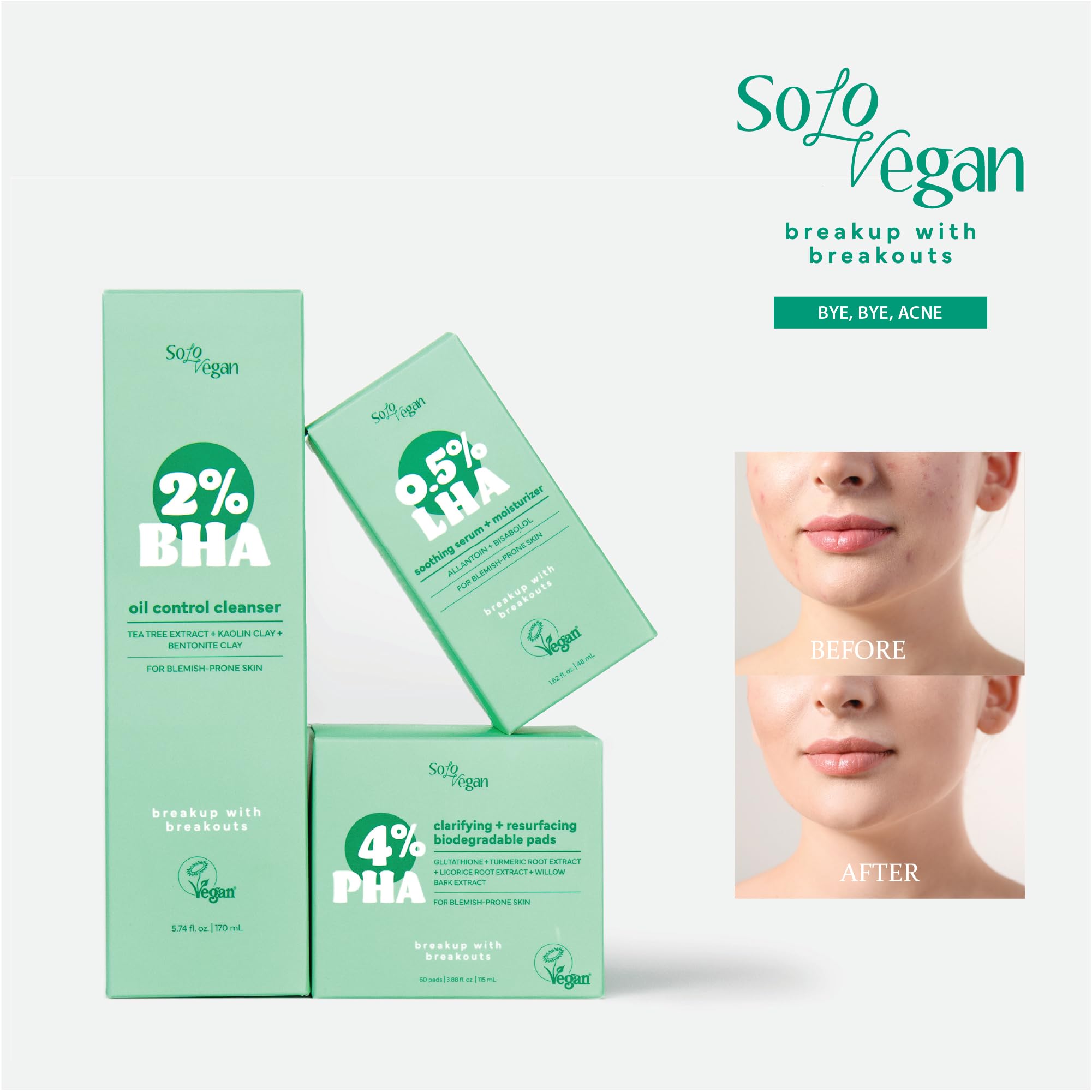 SoloVegan 4% PHA Toner Pads | Vegan Korean Skincare for Sensitive, Acne-Prone Skin - 60 ct