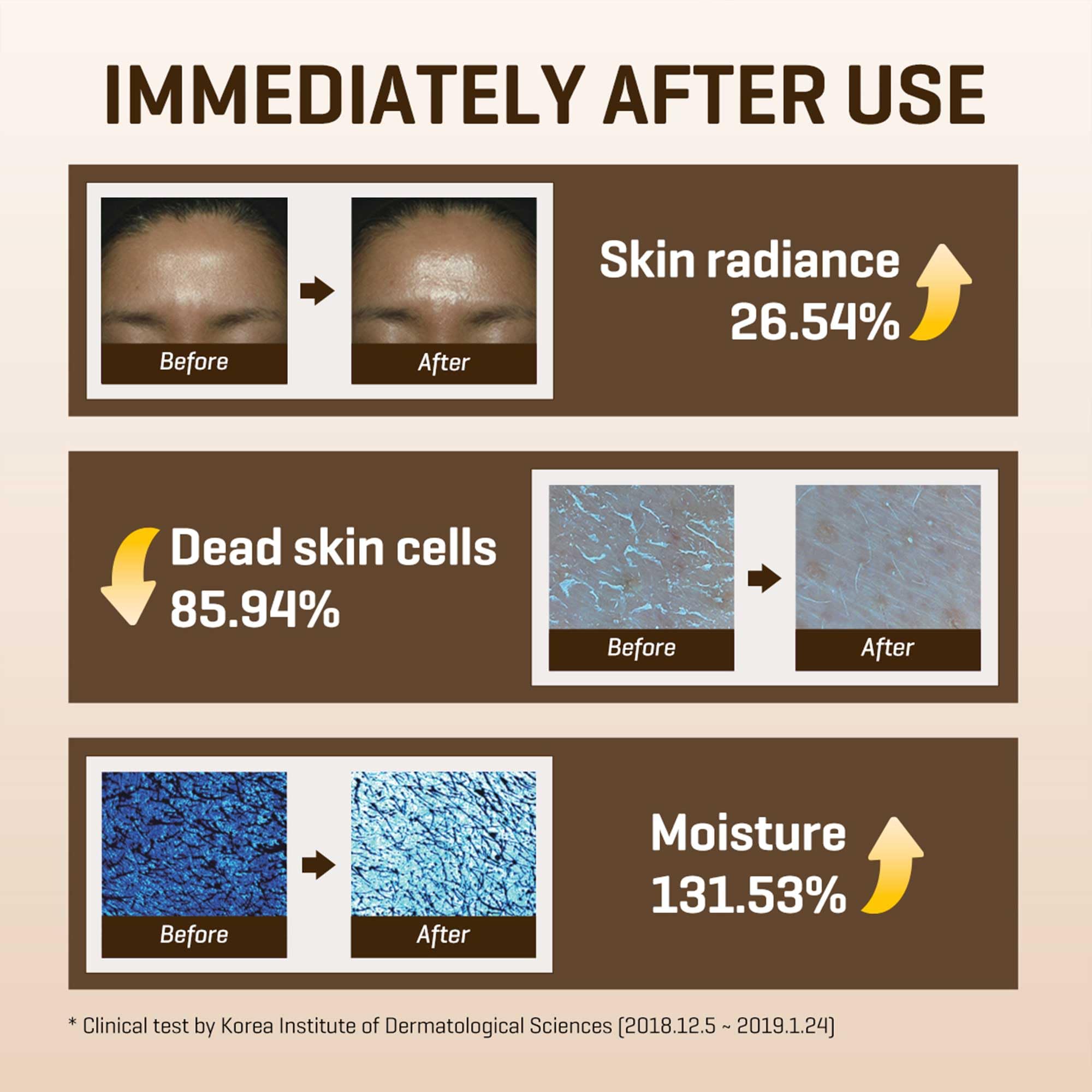 SOME BY MI Galactomyces Vitamin C Glow Toner - 200ml | Brightening Korean Skincare