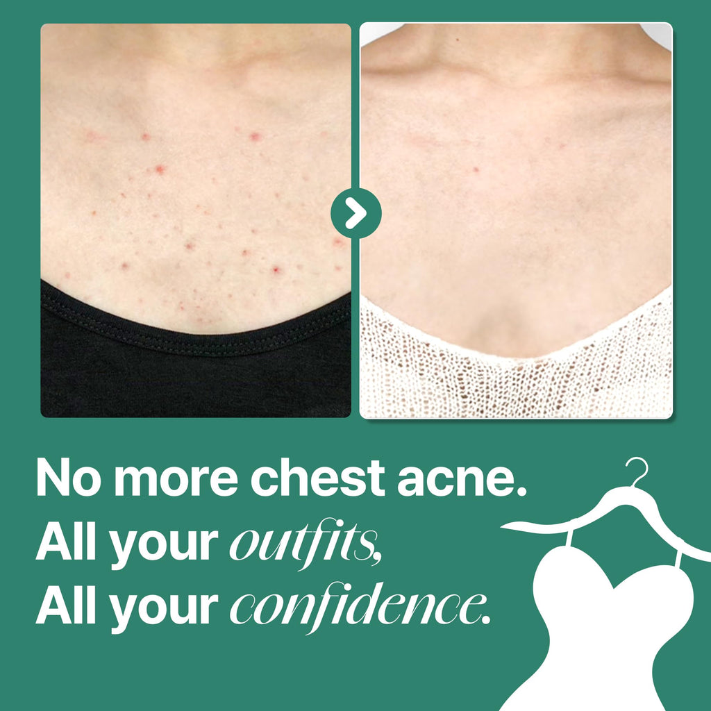 SOME BY MI AHA BHA PHA 30 Days Miracle Acne Clear Body Cleanser – Pack of 2