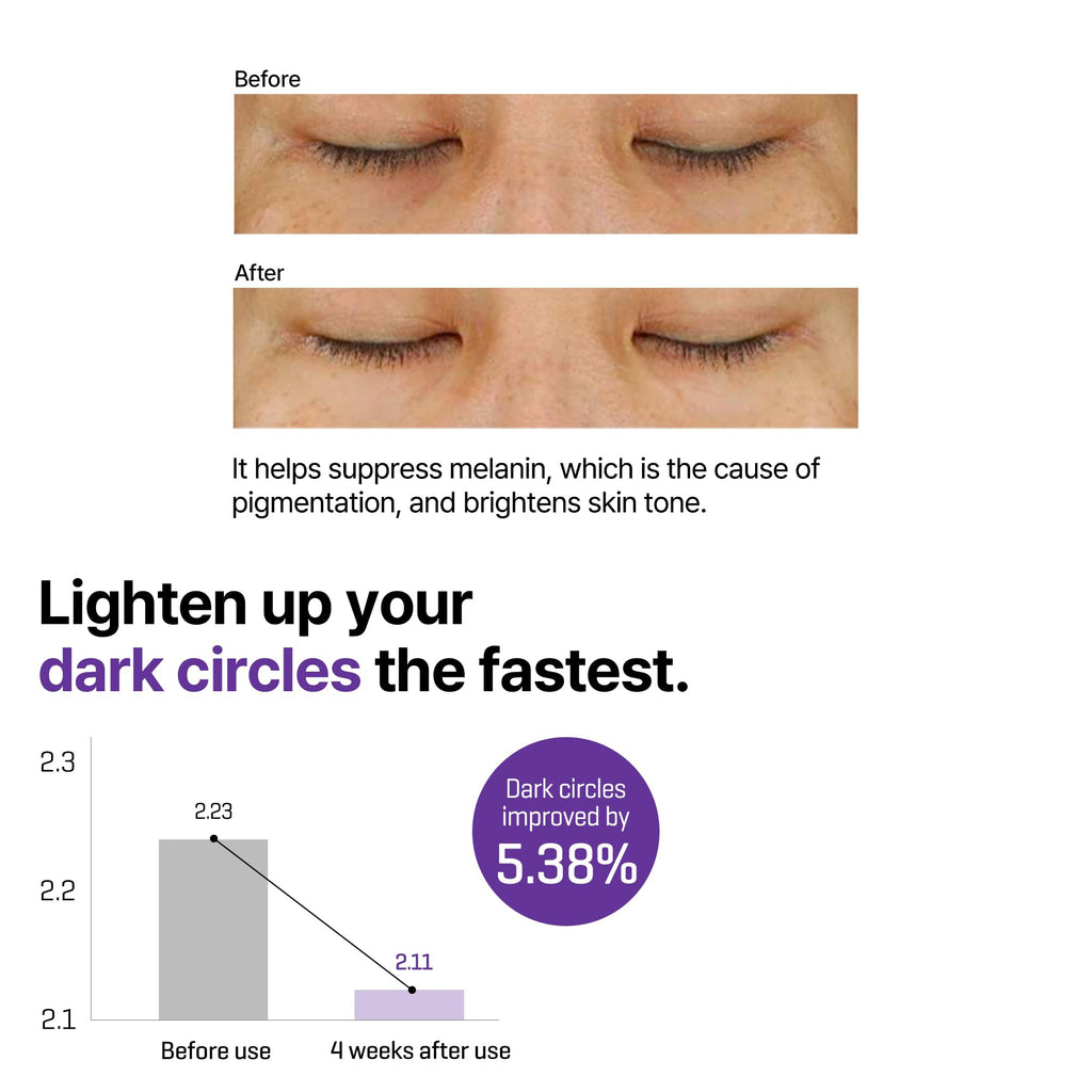 SOME BY MI Retinol Intense Advanced Triple Action Eye Cream – 1.01 Oz / 30 ml | Under-Eye Brightening & Fine Line Smoothing
