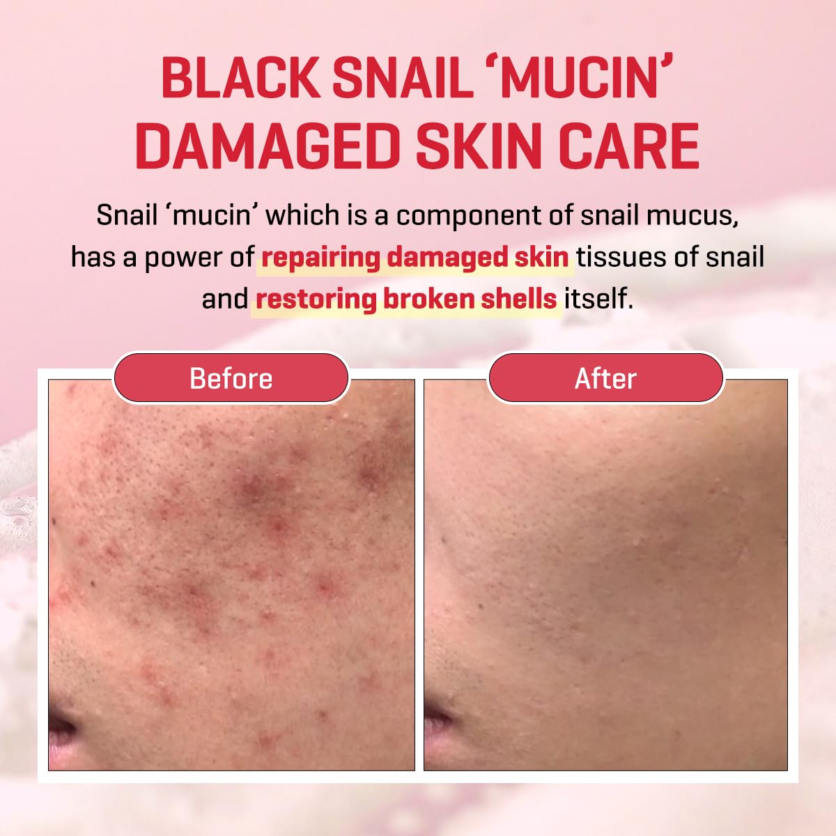 SOME BY MI Snail Trucica Miracle Repair Serum – 50ml for Sensitive Skin & Post-Acne Support | Korean Skincare