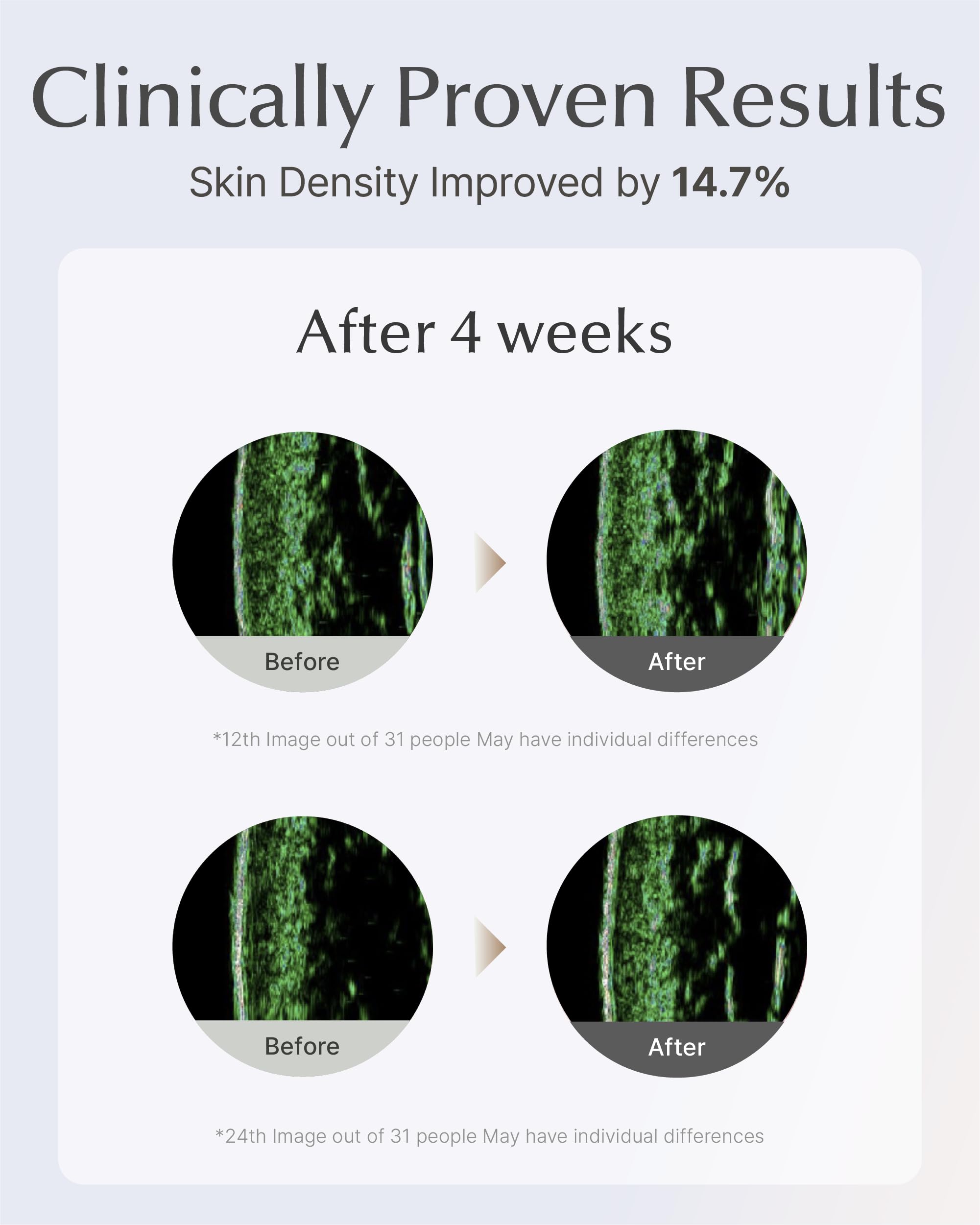 SOORYEHAN Lifting Ampoule Serum – 2.02 fl oz | 5% Niacinamide + Triple Collagen