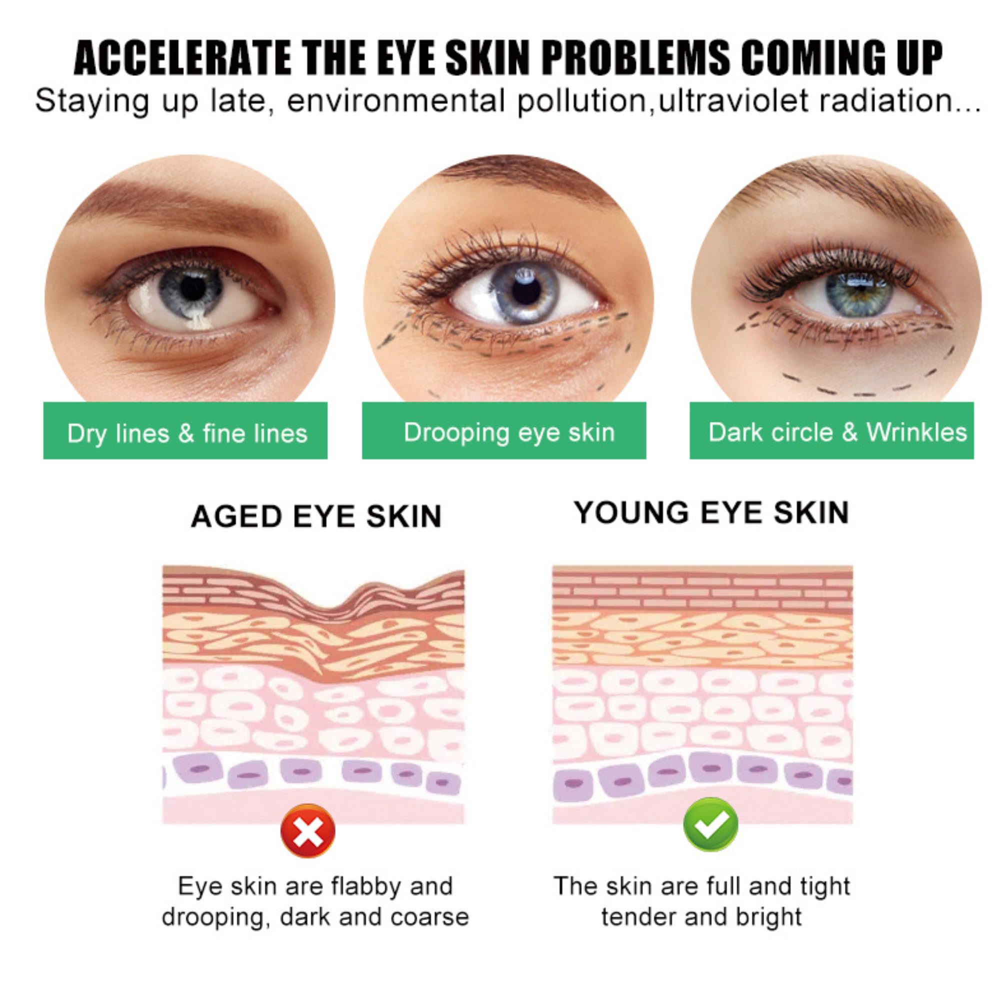 SORYA Caffeine Eye Cream for Dark Circles & Puffiness – Anti-Aging Day & Night Formula with Niacinamide & Peptides