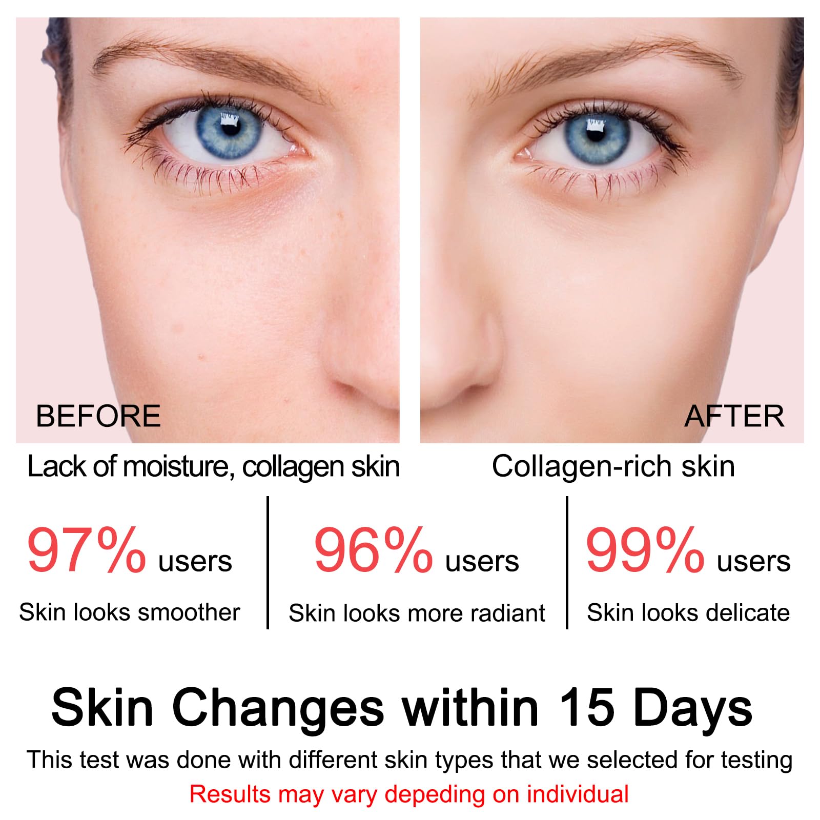 SOYUB Collagen Jelly Cream – Niacinamide, Hydration & Elasticity for All Skin Types