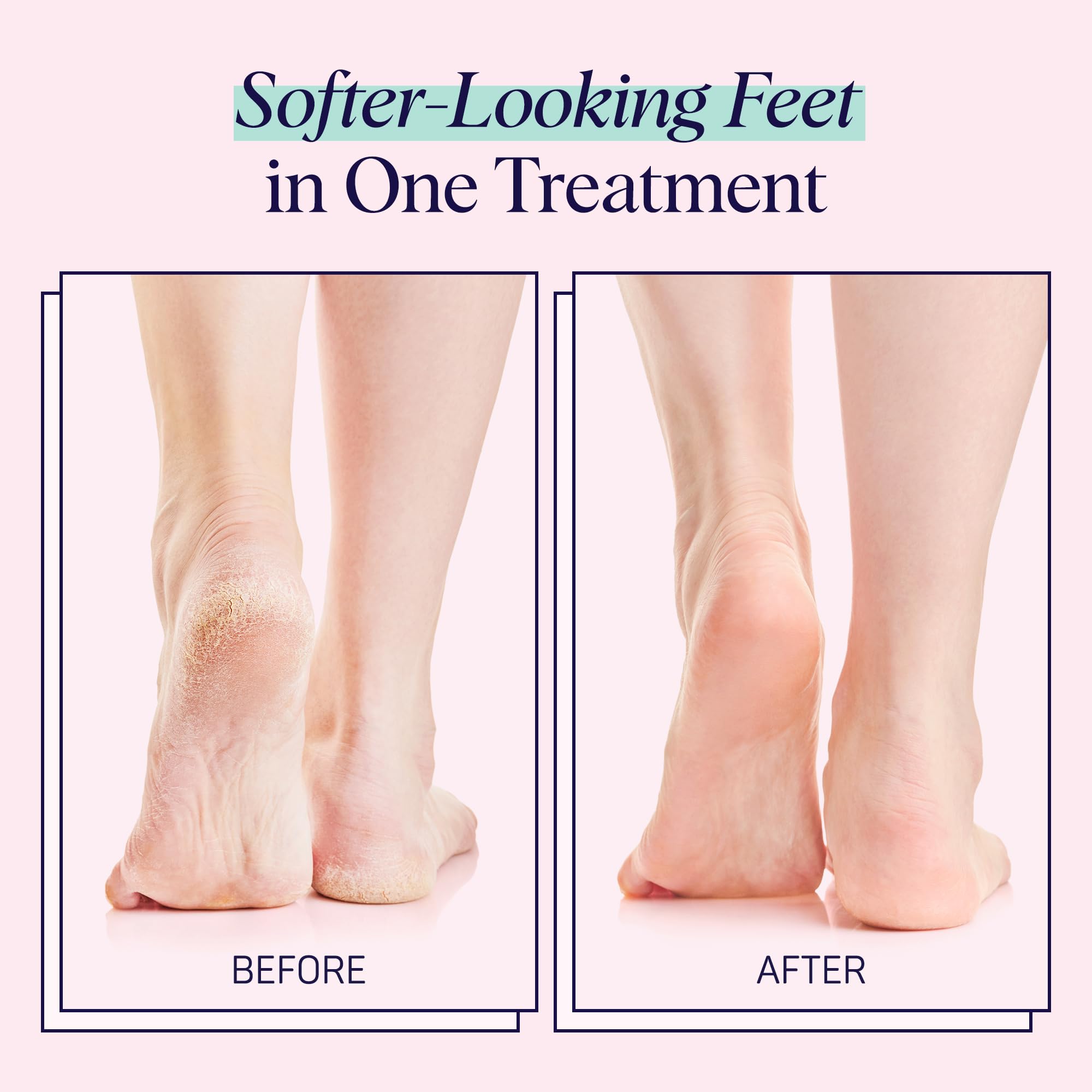 SpaLife Moisturizing Foot Sockies — Intensive Hydration Foot Mask for Dry, Cracked Feet | 8 Pack