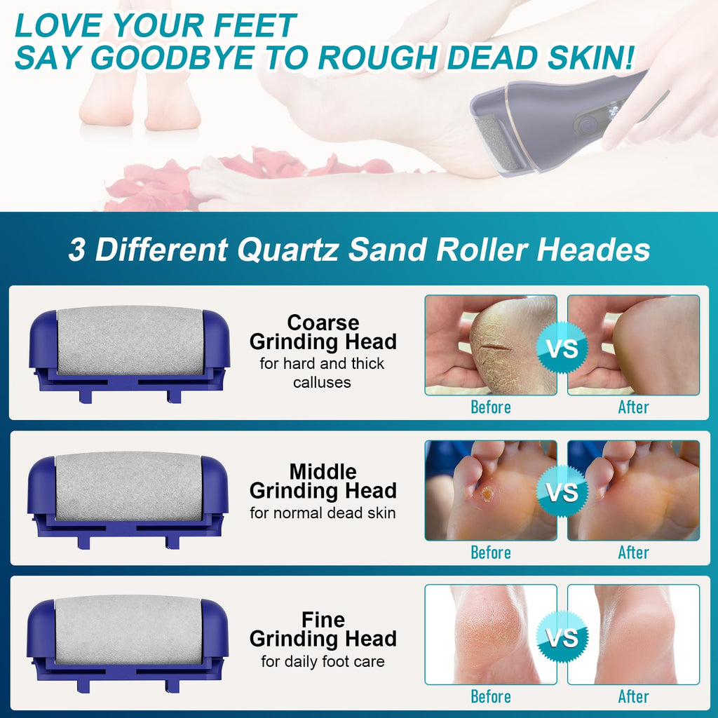 Spriaq Electric Callus Remover for Feet – 16-in-1 Rechargeable Pedicure Kit (Blue)