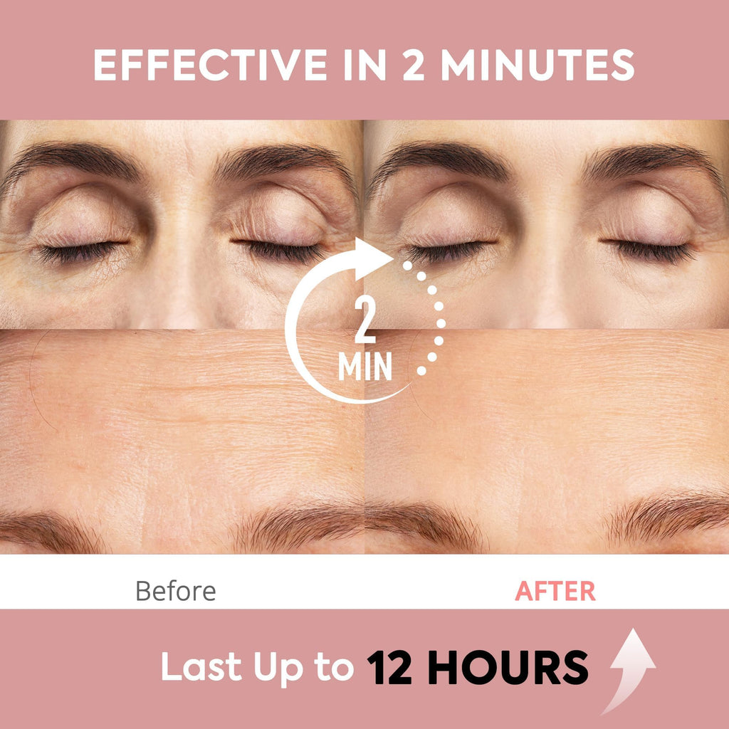 St. Mege Instant Eye & Face Lift Cream — 2-Minute Temporary Firming (1 fl oz)