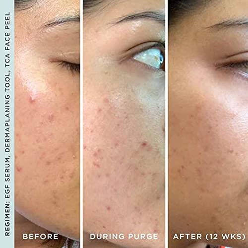 StackedSkincare Hydrating EGF Serum | Lightweight Facial Serum for Smoother Texture & Radiance
