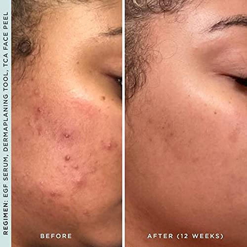 StackedSkincare Hydrating EGF Serum | Lightweight Facial Serum for Smoother Texture & Radiance