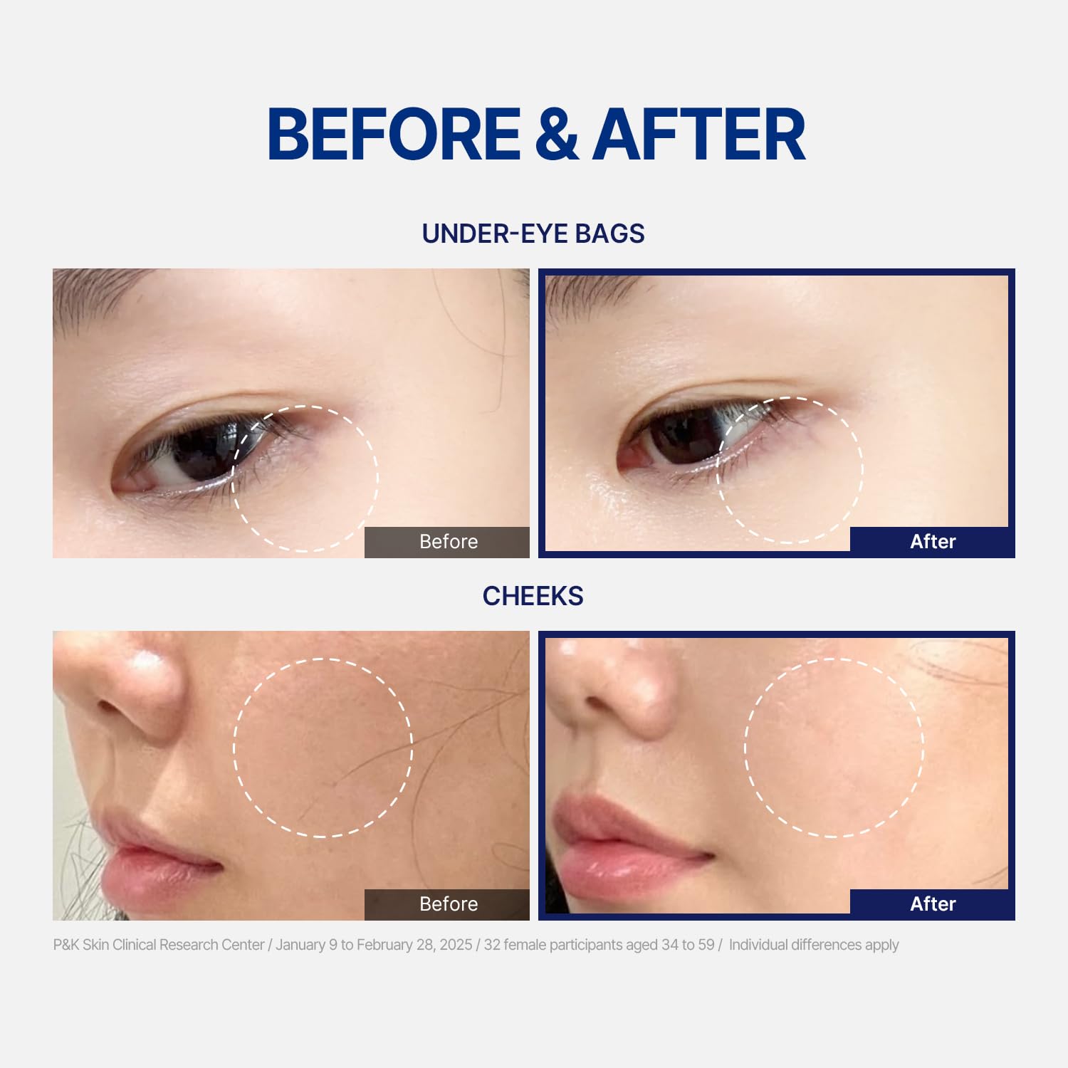 StayUth Wrinkle Spot Serum – Targeted Korean Skincare for Radiance, Hydration & Visible Smoothing (15ml)
