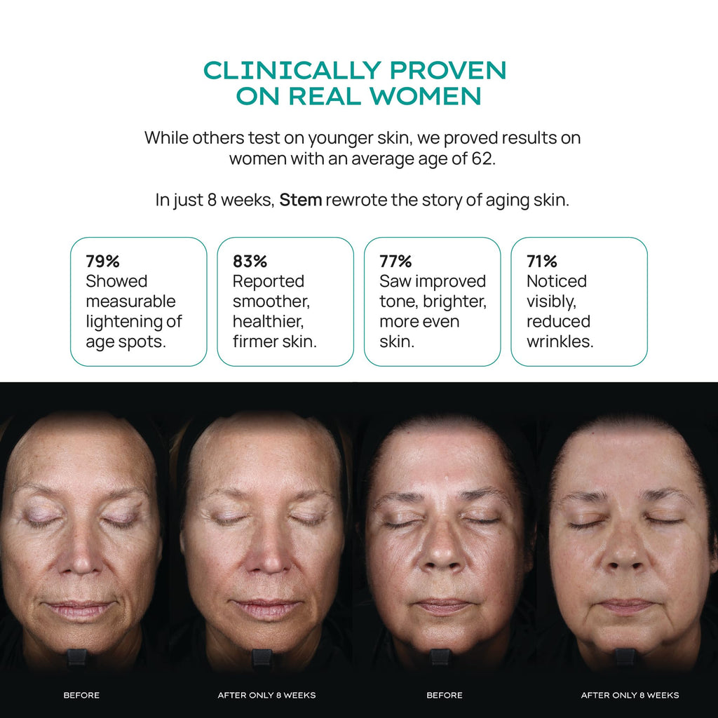 ReVitalize Night Cream — Stem Cell Serum & Niacinamide Moisturizer | STEM Natural Intelligence