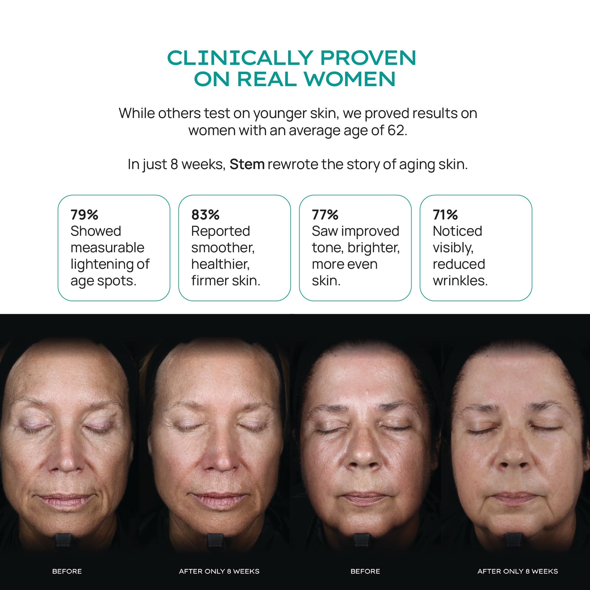 ReVitalize Night Cream — Stem Cell Serum & Niacinamide Moisturizer | STEM Natural Intelligence