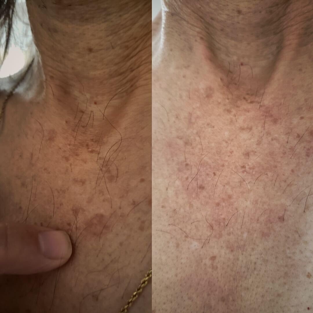 Stop Guessing BioFormula Select – Fast Dark Spot Remover Body Wash