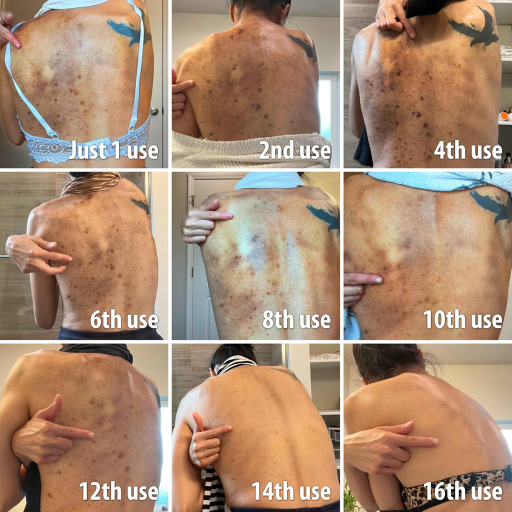Stop Guessing BioFormula Select – Fast Dark Spot Remover Body Wash