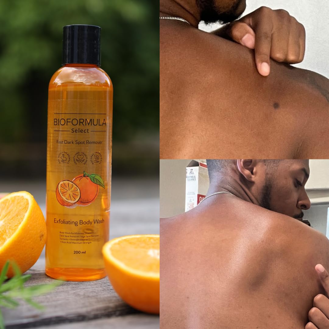 Stop Guessing BioFormula Select – Fast Dark Spot Remover Body Wash
