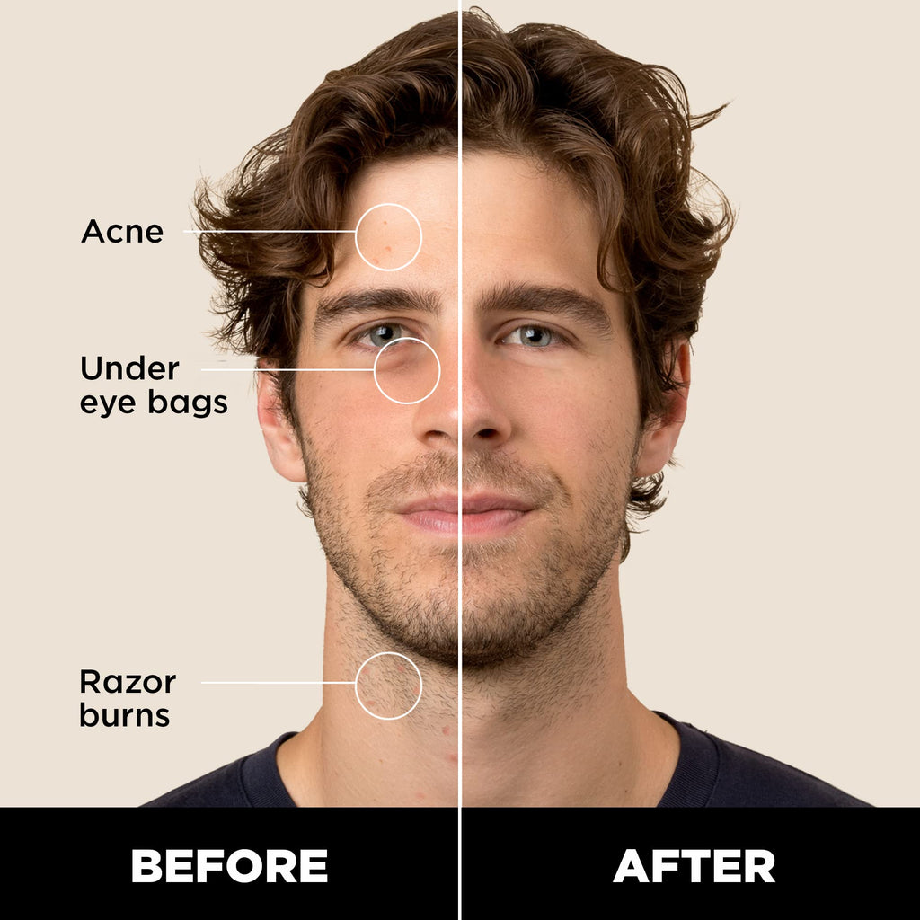 Stryx Concealer Stick Tool for Men - Medium Mahogany | Adaptable Shade & Undetectable Coverage