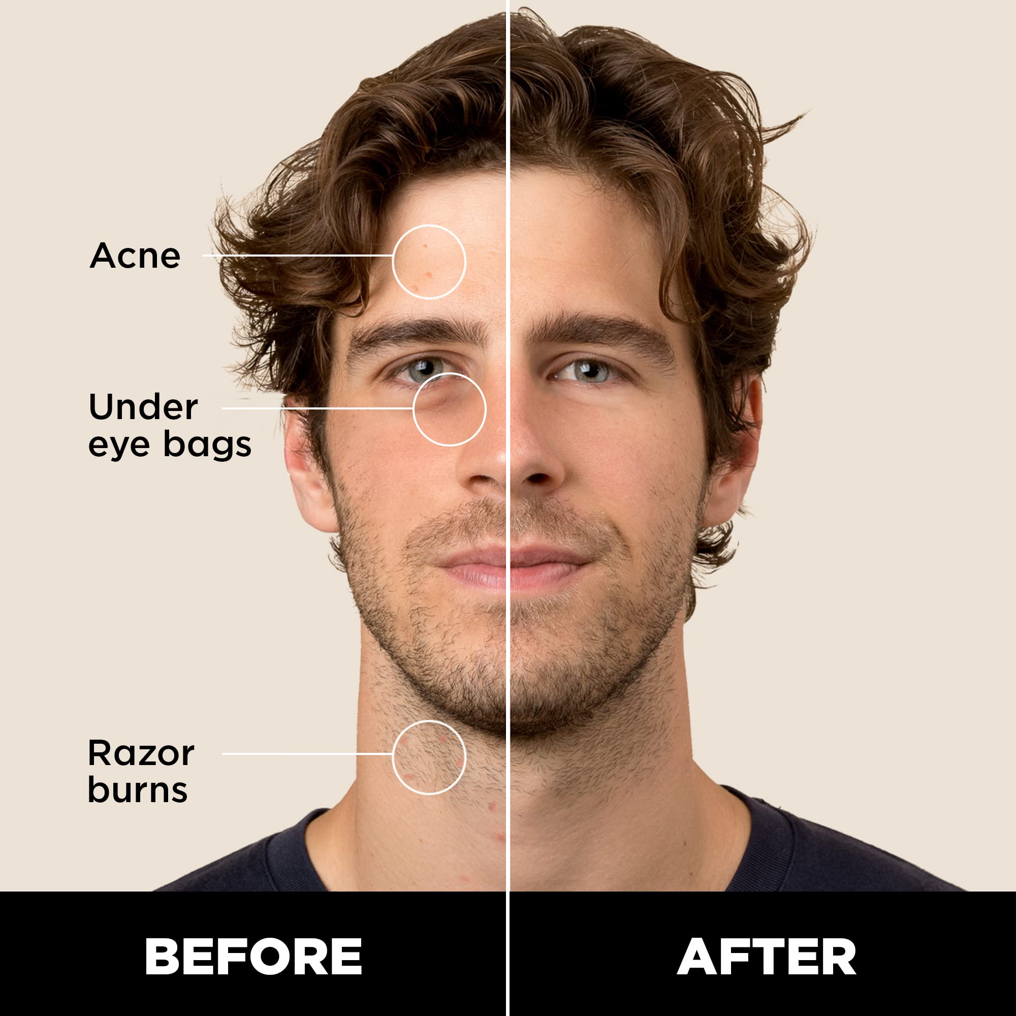 Stryx Concealer Stick Tool for Men - Medium Mahogany | Adaptable Shade & Undetectable Coverage