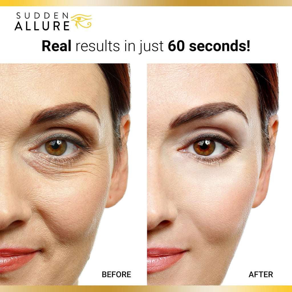 Sudden Allure Instant Under Eye Treatment Serum – Tighten, Lift & Brighten (2x10ml, Made in USA)