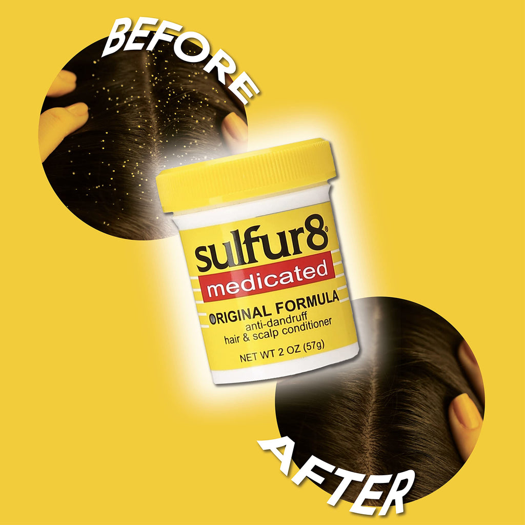 Sulfur 8 Medicated Anti-Dandruff Hair & Scalp Conditioner 2 oz (Pack of 2) – Soothes Itchy Scalp, Moisturizes Hair