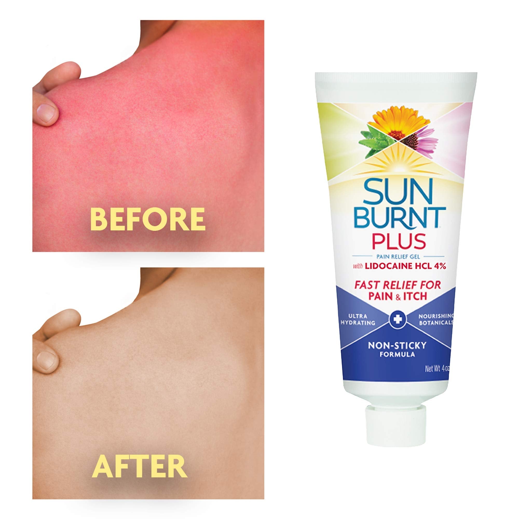 Sunburnt Plus After-Sun Gel with Lidocaine – 4 oz | Fast Cooling & Hydration