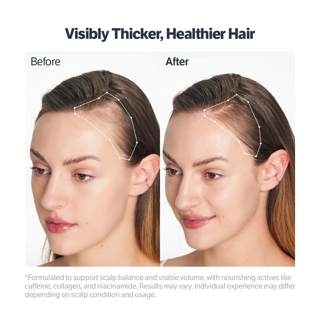 SUNGBOON EDITOR Deep Collagen Retinol Scalp Serum | Roll-On Hair Growth & Thickening
