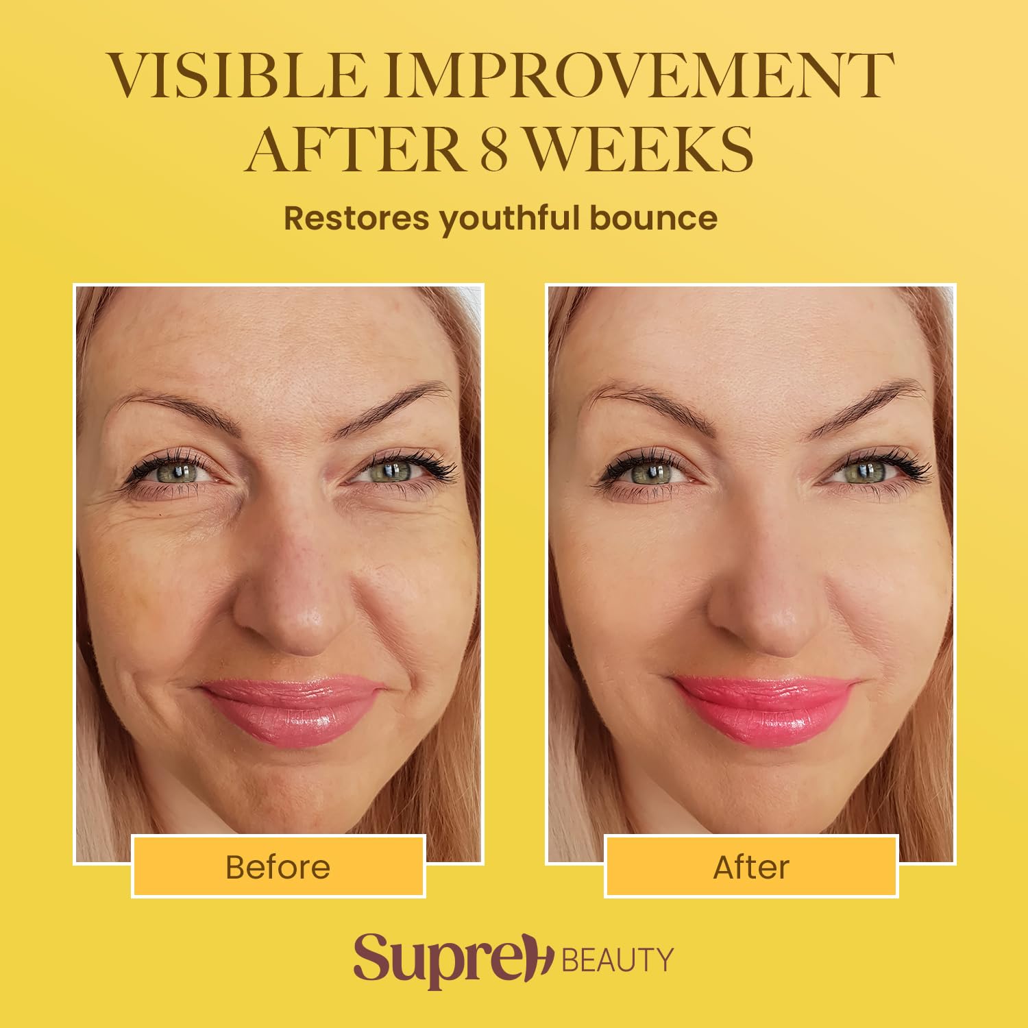 SupreH Bee Venom Cream Wrinkle Filler – Instant Lift & Eye Tightener, 50 ml