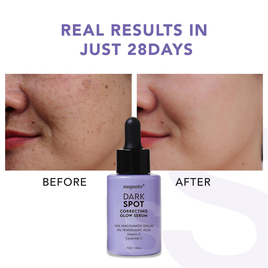 Suquato Dark Spot Remover Serum – Brighten, Correct Discoloration & Hydrate with Tranexamic Acid, Niacinamide & Vitamin C (30ml)