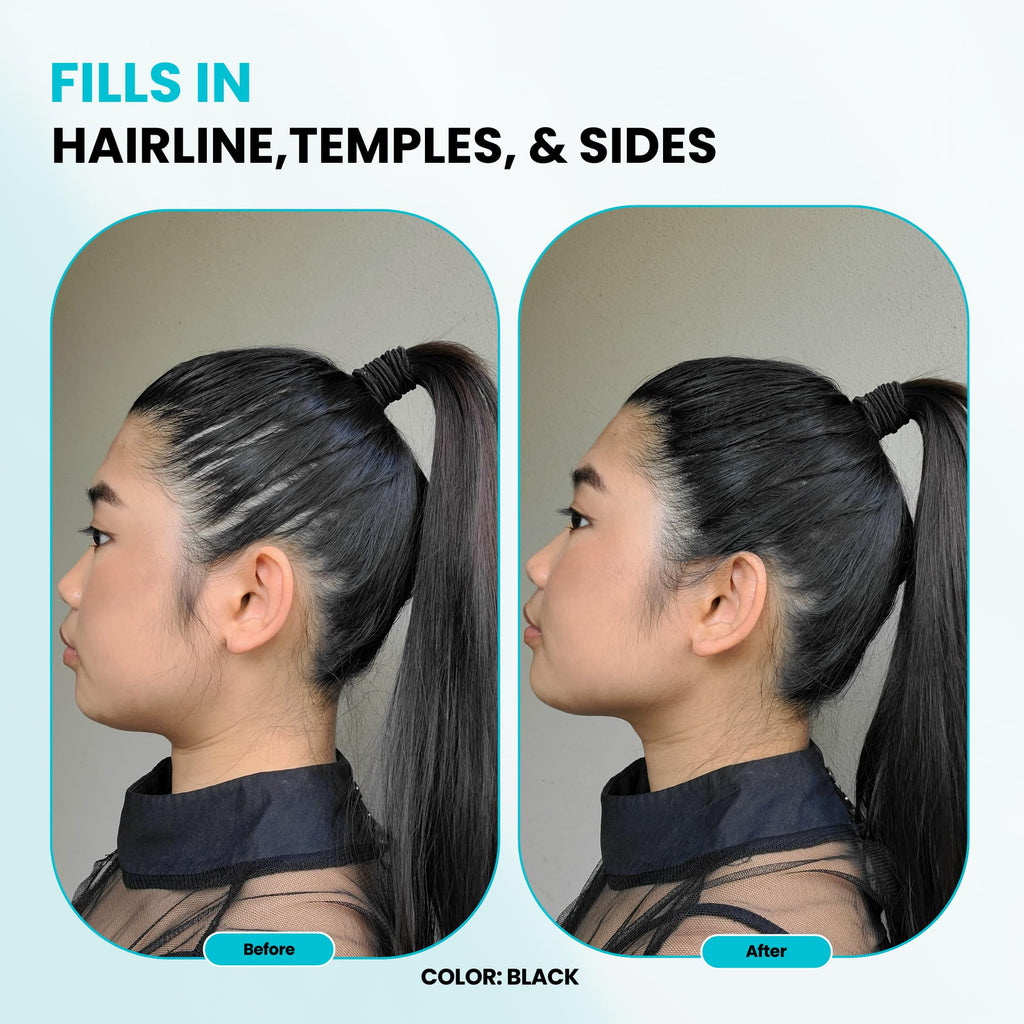 SURETHIK Hair Fibers 15g (Dark Brown) – Fuller, Natural-Looking Hair Coverage